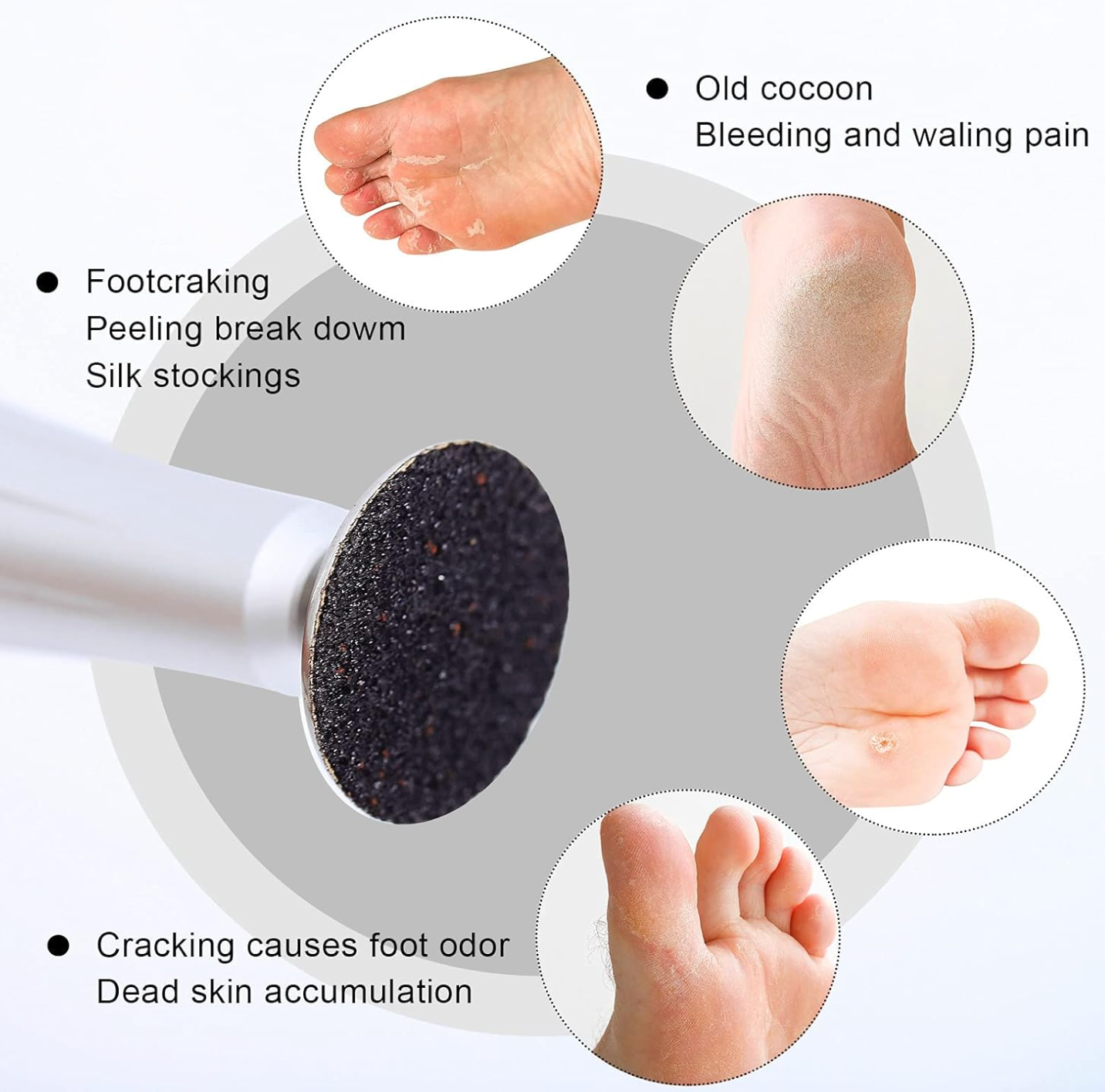 100 PCS Replacement Sandpaper Discs for Foot File Ø35mm