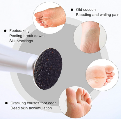 100 PCS Replacement Sandpaper Discs for Foot File Ø35mm